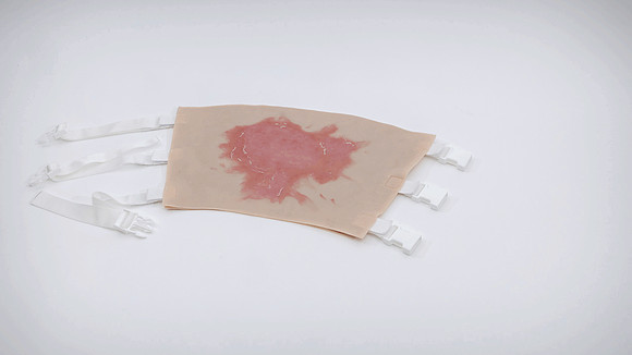 ts-250807-upper-leg-scald